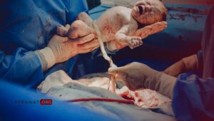 risiko ikterik neonatus