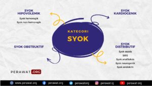 cara menentukan kelas syok