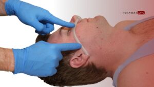 SOP Pemasangan OPA dan NPA