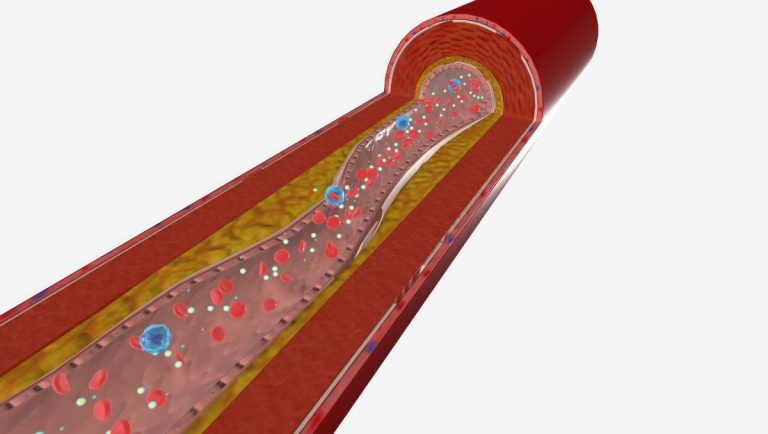 Pemeriksaan Kolesterol