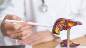 Pemeriksaan Laboratorium Hati