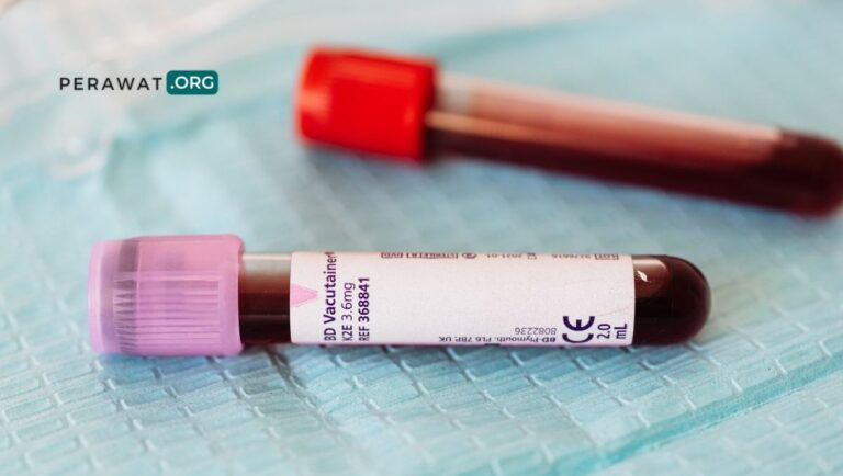 Nilai Normal Leukosit WBC