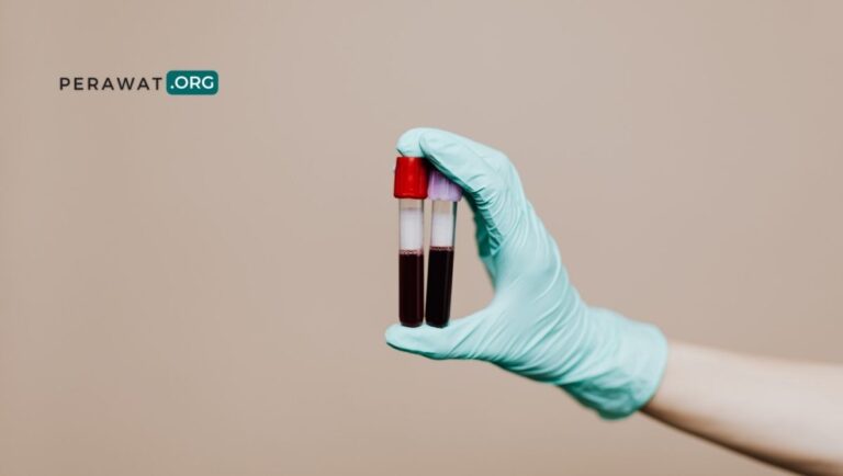 Nilai Normal Trombosit PLT